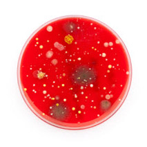 Microorganisms in a dish